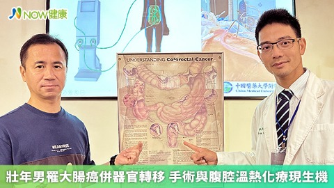 壯年男罹大腸癌併器官轉移 手術與腹腔溫熱化療現生機