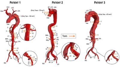 What is Medical Image Processing?