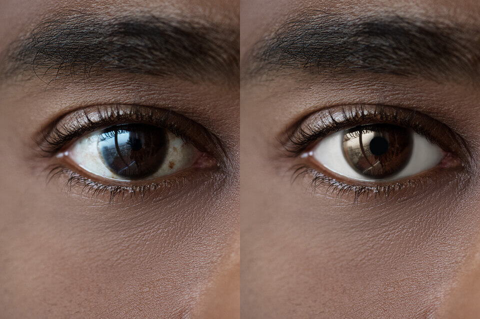 eye macro photo