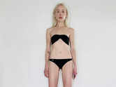 ​Theresia Fischer spent a crore to increase the length of her legs​