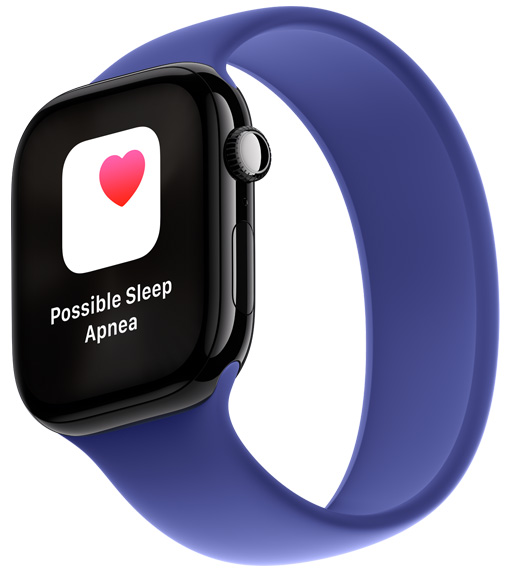 Obavijest o mogućoj apneji u snu na Apple Watchu Series 10.