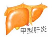 疾病分类