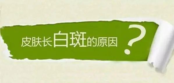 江西南昌白癜风治疗医院“本周重点榜单”，白癜风的病因究竟是什么呢？