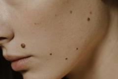 Close up of woman's skin