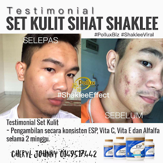 Kebaikan Vitamin E Untuk Kecantikan Kulit & Kesuburan Lelaki Kebaikan Vitamin E Untuk Kecantikan Kulit & Kesuburan Lelaki