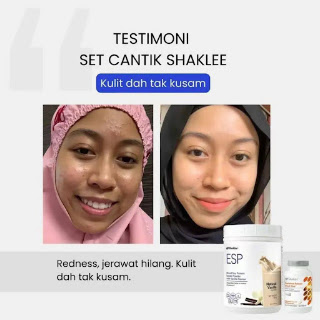Inner Glow Set Shaklee ESP Strawberry dan SR Vitamin C Plus Inner Glow Set Shaklee ESP Strawberry dan SR Vitamin C Plus