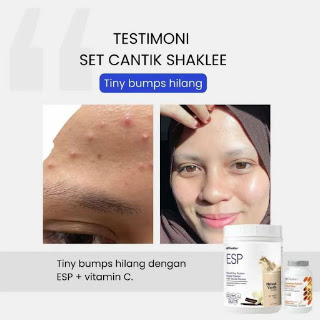 Inner Glow Set Shaklee ESP Strawberry dan SR Vitamin C Plus Inner Glow Set Shaklee ESP Strawberry dan SR Vitamin C Plus