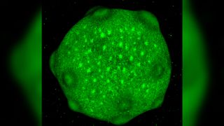 Fluorescent green image showing a roughly spherical brain organoid