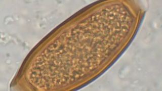 Microscope image of a parasite egg.