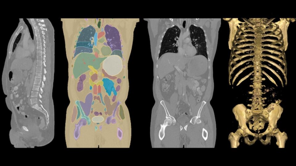 Simulated 2D and 3D CT scans.