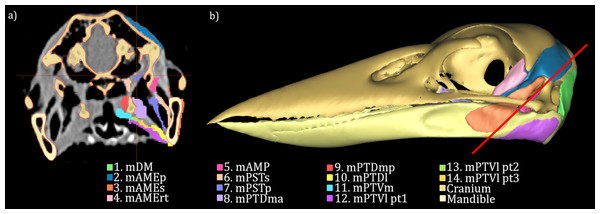 Segmentation of the CT data.