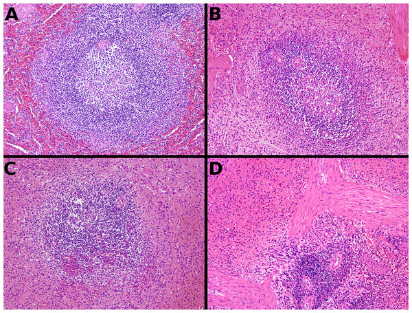 Representative fixative histomorphology—spleen.