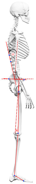 Marker placement and angle calculations.