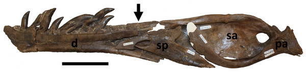 Reconstruction of right mandible in medial view.