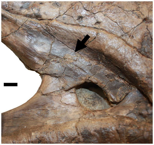 Lesion associated with the proxmaxillary fenestra.