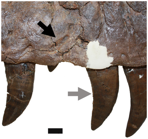 Damage on the right maxilla.