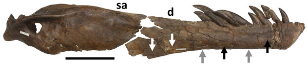 Restoration of right mandible.