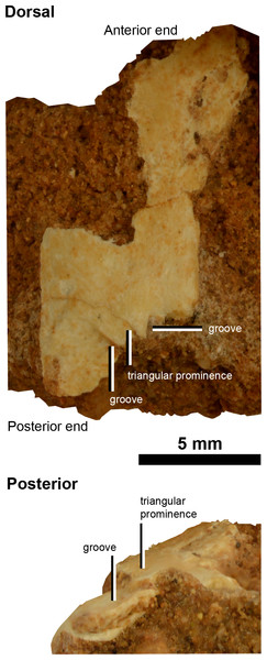 Scapula of IVPP V20341.