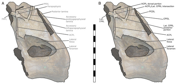 NHMUK R2095, the holotype and only vertebra of Xenoposeidon proneneukos, in left lateral view, with interpretative drawings.