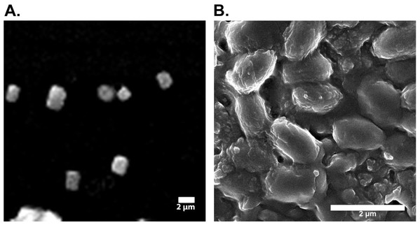 Electron micrographs of silk fibroin and sericin.