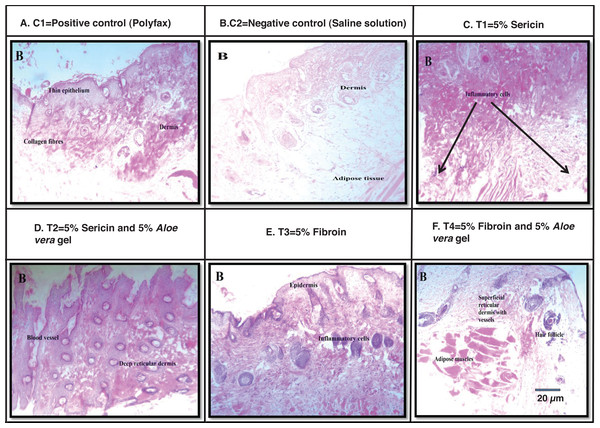 H & E staining showing the histological changes in diabetic mice skin at post-wounding day 10 in different treatment groups.