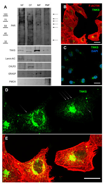 Endogenous TNKS and PAR distribution in epithelial cells.