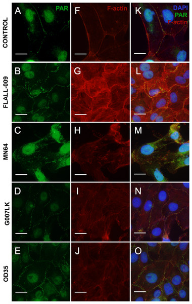 TNKS inhibitors hampered PAR belt synthesis and altered the subcortical actin ring.