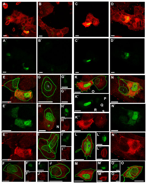 Transfection with Tol2-GgVCL or Tol2-GgVCL/*TBM.