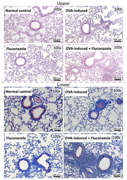 Representative lung histological pictures of control, asthma, fluconazole in normal mice, and fluconazole in asthma as stained by Hematoxylin and Eosin color (upper part) and Masson’s Trichrome (lower part) are demonstrated, (n = 6/group).