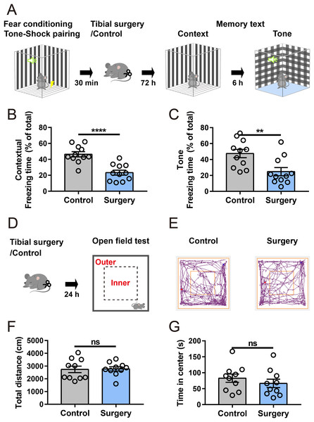 Tibial surgery leads to cognitive decline.