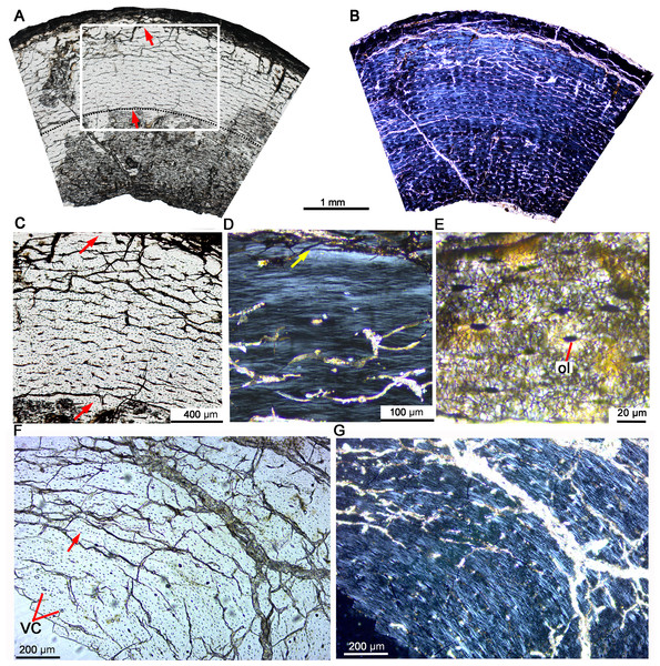 Bone microstructure of the tibia and fibula in early juvenile Yinlong downsi IVPP V18677.