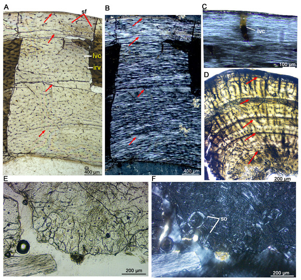 Bone microstructure of the limb bones in late Juvenile Yinlong downsi (IVPP V33266).