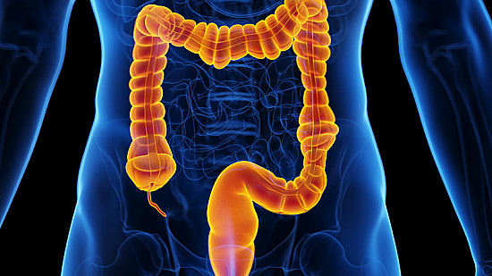 When — and how — should you be screened for colon cancer? featured image