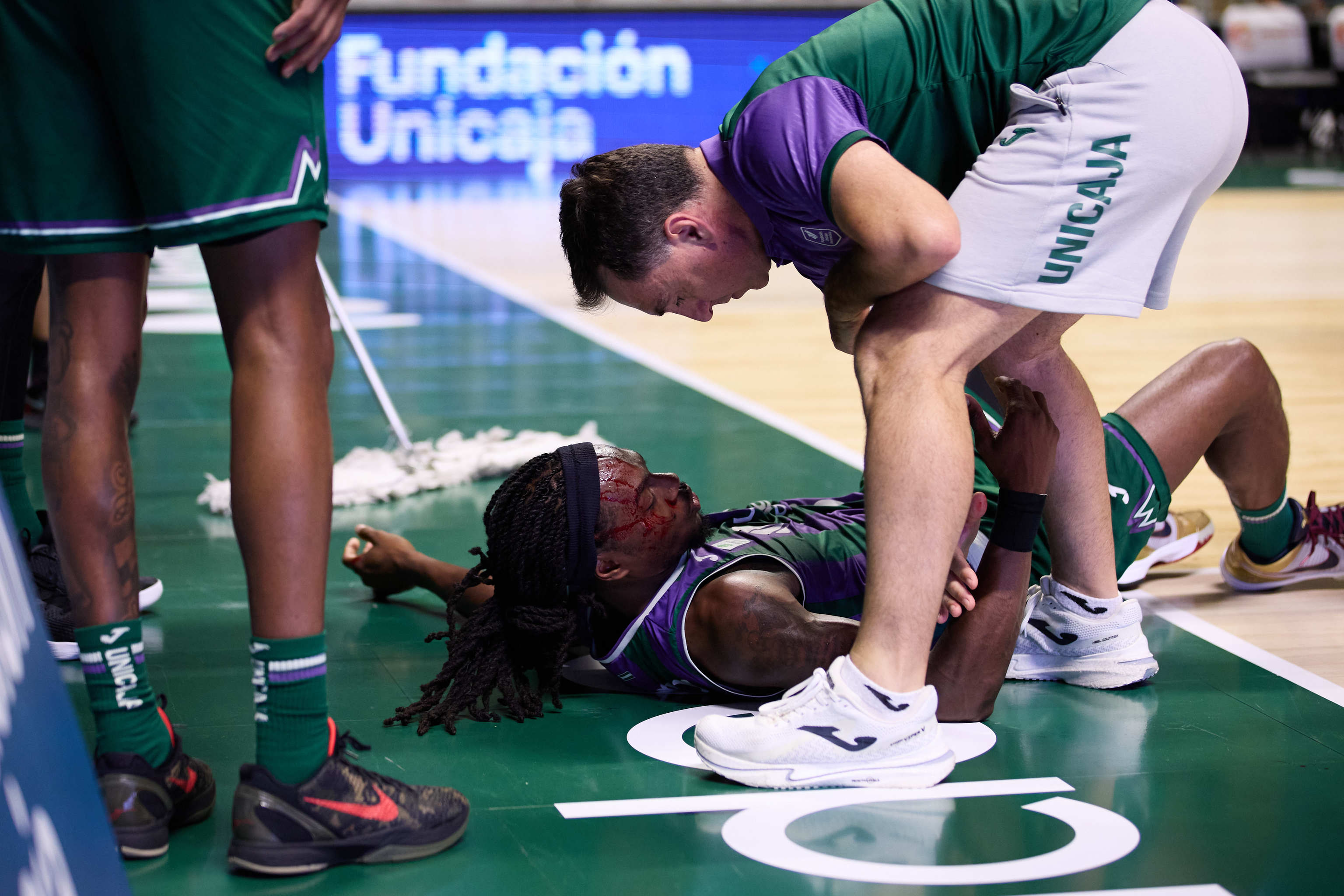 Kendrick Perry, ensangrentado, tras el codazo de Musa, en el Carpena.
