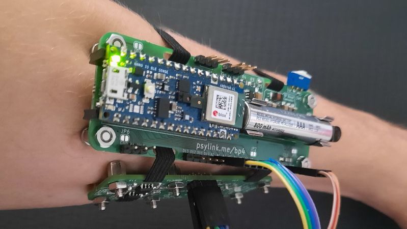Electromyography