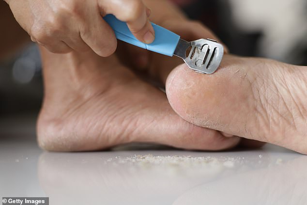 Some nail salons offer callus removal as part of a pedicure, opting for a cheese grater-like device or 'callus shaver' (pictured: stock image)