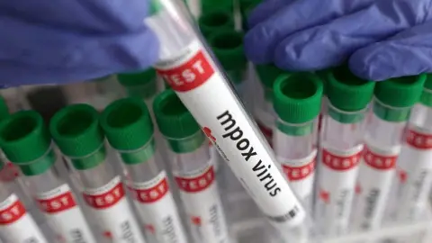 Reuters a tray of mpox virus vaccines, with purple surgical gloves visible