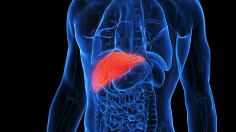 An illustration of an inflamed liver.