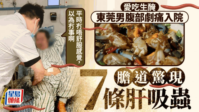 東莞男愛吃生腌海鮮，膽道內驚現7條肝吸蟲且大量蟲卵。