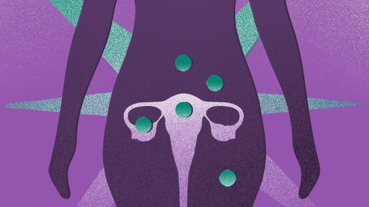 woman ovarian pain uterus pain spots 