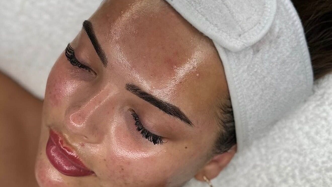 Tratamento facial em Ma Belle Clinic, Lisboa, Lisboa, PT, destacando a pele radiante e cuidada.