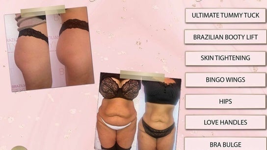 Body Sculpting Herts Biggleswade