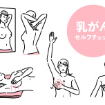 ブレストチェック