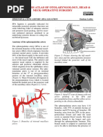 Sphenopalatine Artery - SPA - Ligation