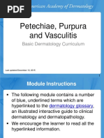 Petechiae Purpura and Vasculitis