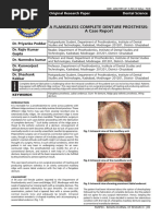 A Flangeless Complete Denture Prosthesis A Case Report April 2017 7862206681 3603082