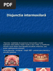 Disjuncția Maxilară1