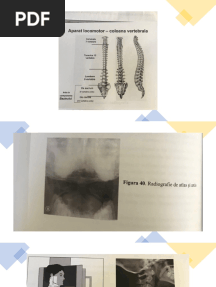 RADIOGRAFII 
