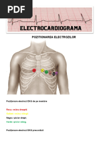 Pozitionarea Electrozilor: Poziționare Electrozi EKG de Pe Membre
