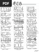 21 ECG Conditions